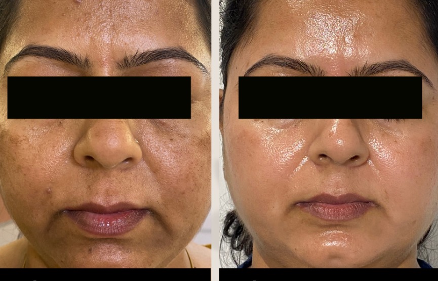#