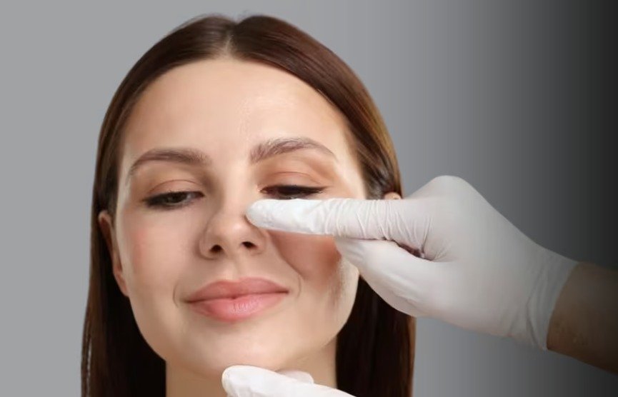 Cara Hair Transplant Clinic