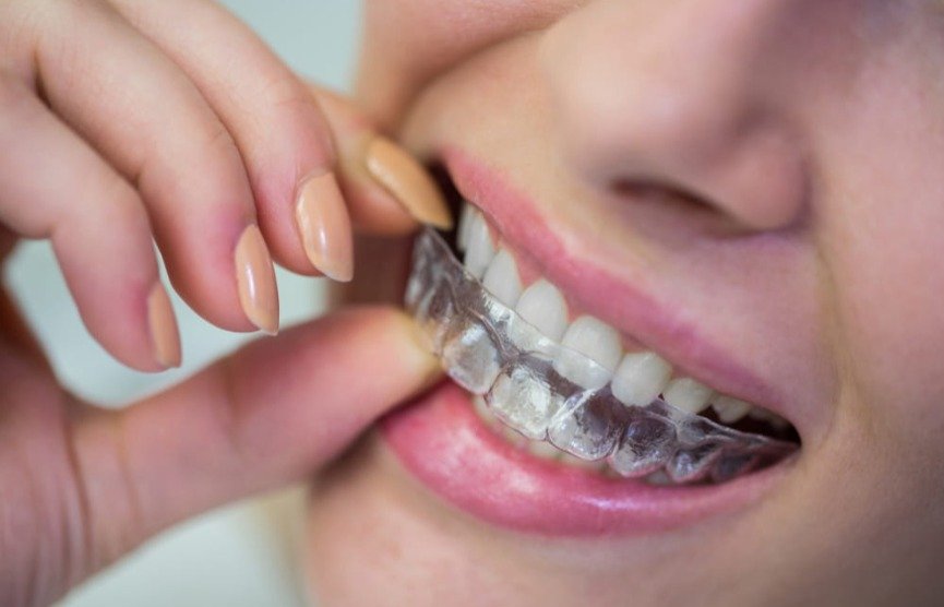 Smylo Dental & Implant Center