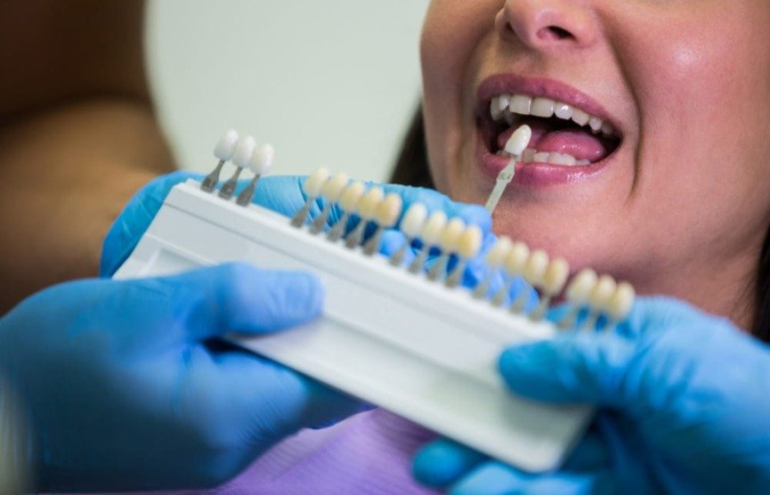 Smylo Dental & Implant Center